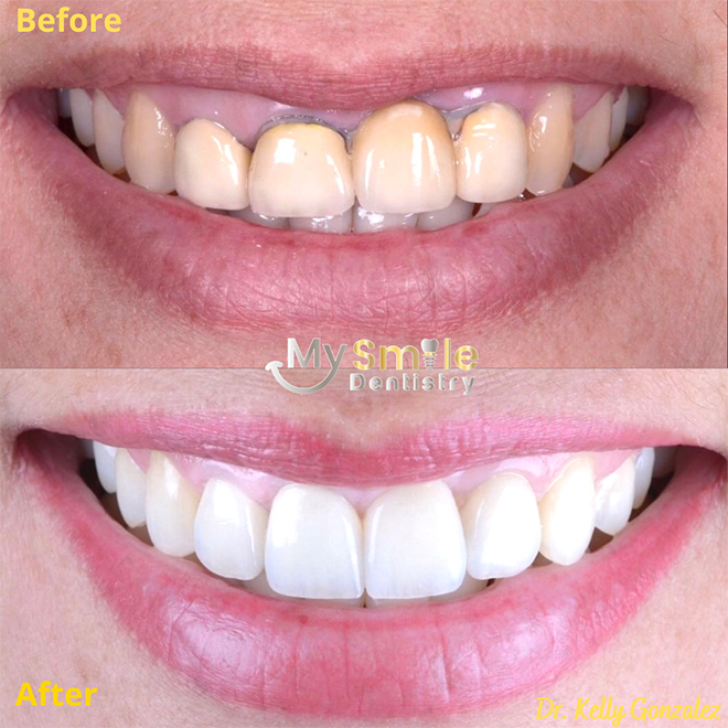 My Smile Dentistry | Fillings, Laser Dentistry and ClearCorrect reg