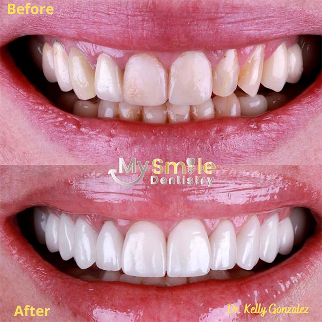 My Smile Dentistry | Digital Radiography, Extractions and Cone Beam Volume CT
