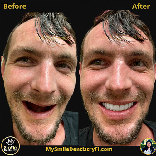 My Smile Dentistry | ClearCorrect reg , Emergency Dental Care and Cone Beam Volume CT