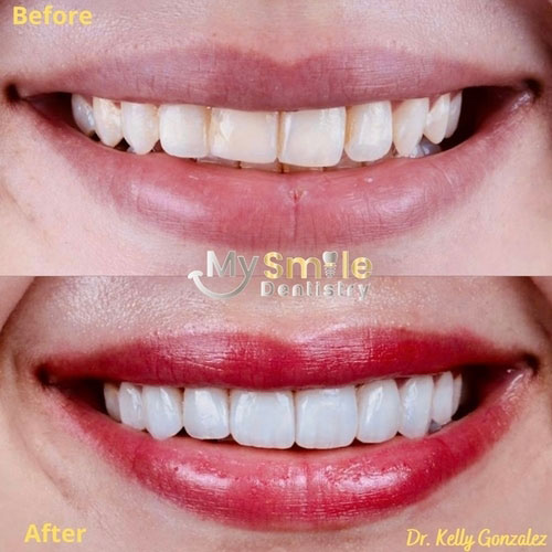 Dentistry Before and After Photos