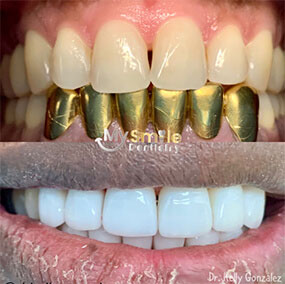 My Smile Dentistry | Orthodontics, Digital Impressions and Occlusal Night Guard