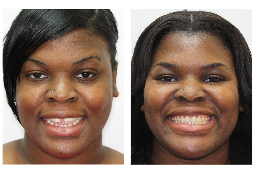 My Smile Dentistry
